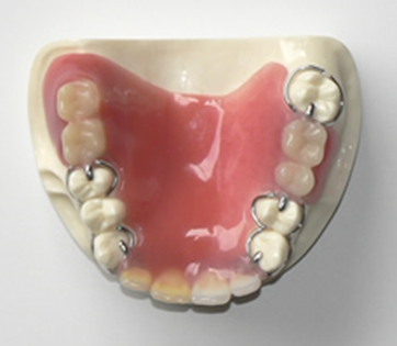 プラスチック義歯 画像
