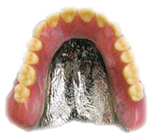 コバルトクロム床義歯 画像
